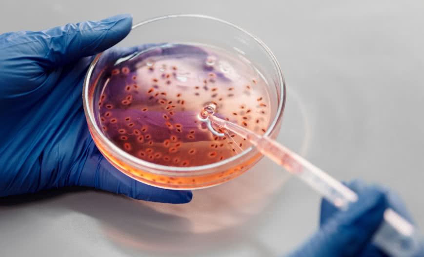 Jakie mikroorganizmy żyją w bioreaktorze?