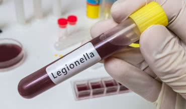 Sposoby zapobiegania bakteriom Legionella w instalacjach