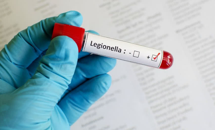 Bakteria Legionella - objawy zakażenia i profilaktyka